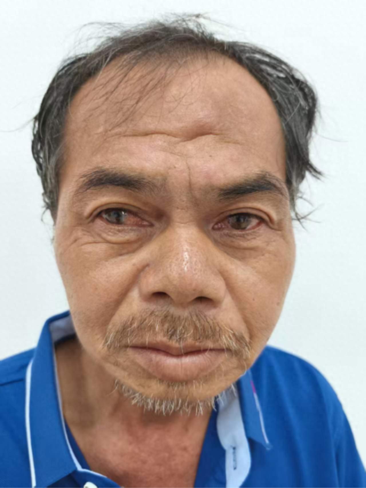 走失者照片 中山市寻亲：六旬老人被救助，自述叫...