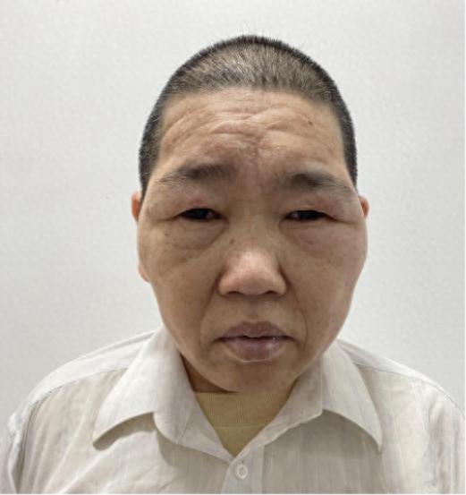 走失者照片 潮州市寻亲：五旬女子被救助，高1米...