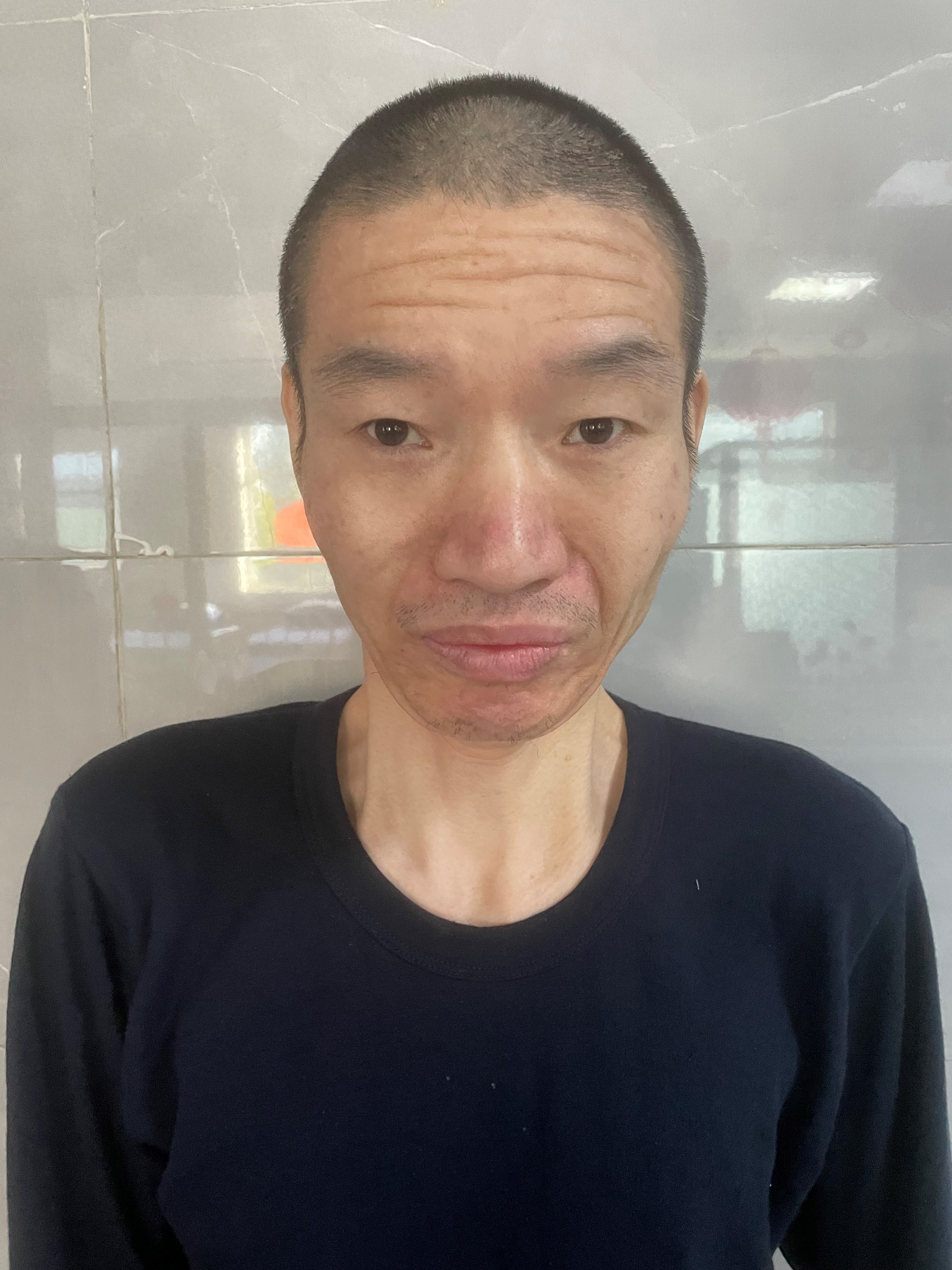走失者照片 北京市寻亲：青年男子被救助，高1米...