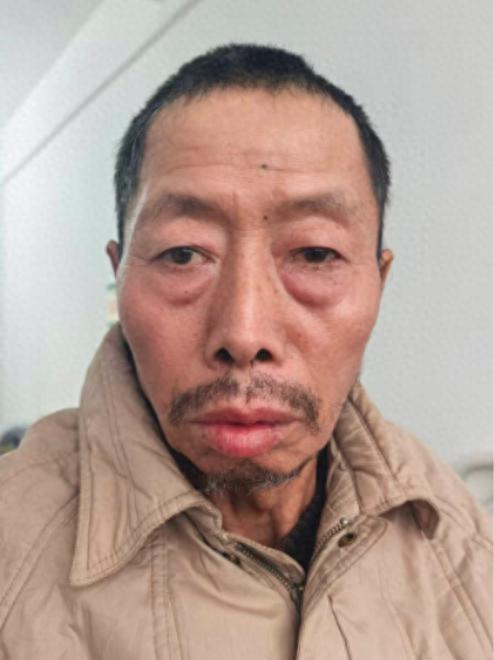 走失者照片 淮南市寻亲：六旬老人被救助，自述是...