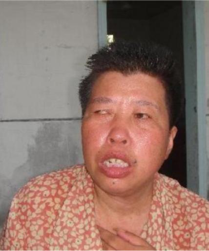 走失者照片 南通市寻亲：七旬老太被救助，双眼斜...