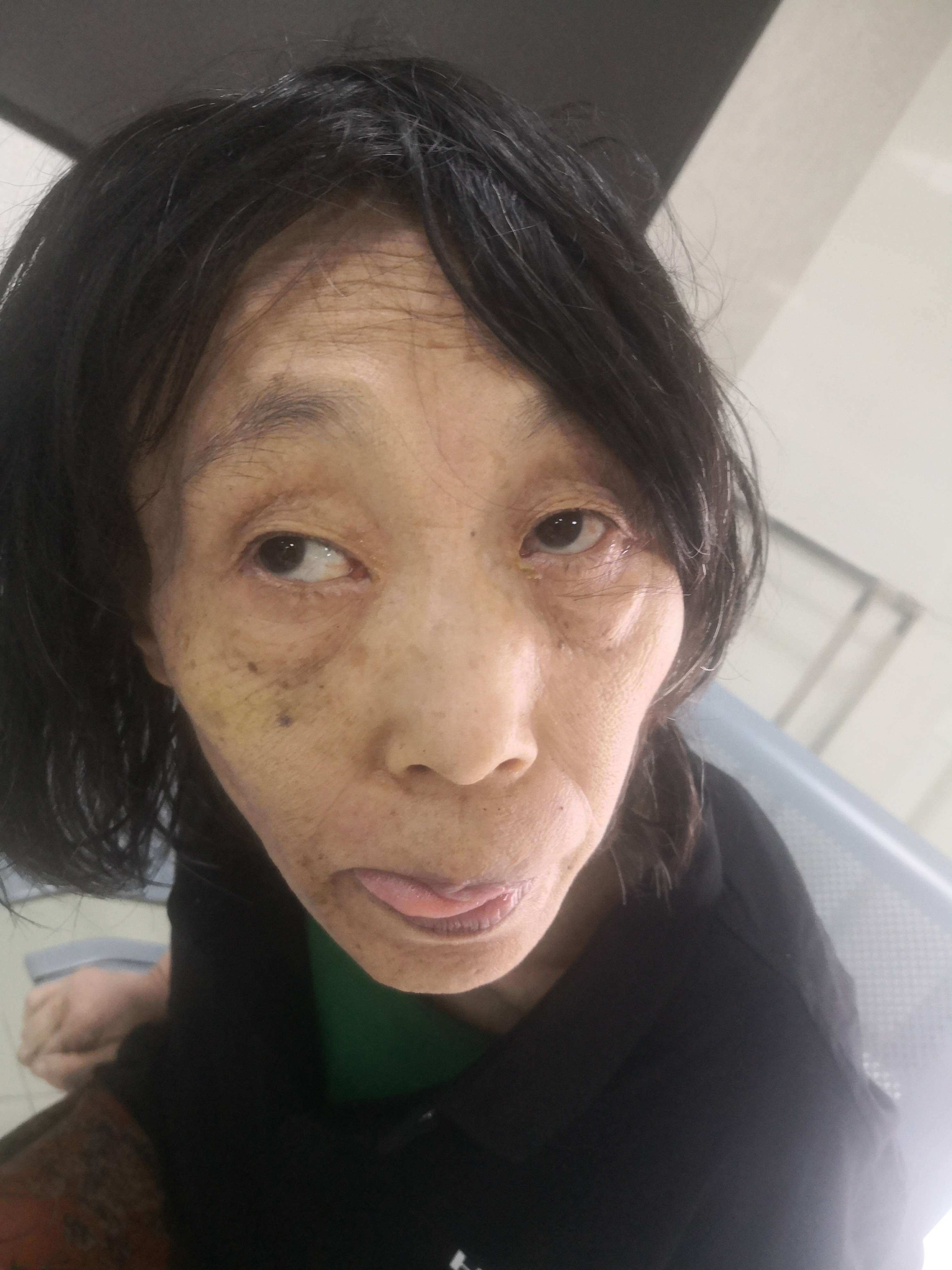 走失者照片 海口市寻亲：六旬老太被救助，穿深色...