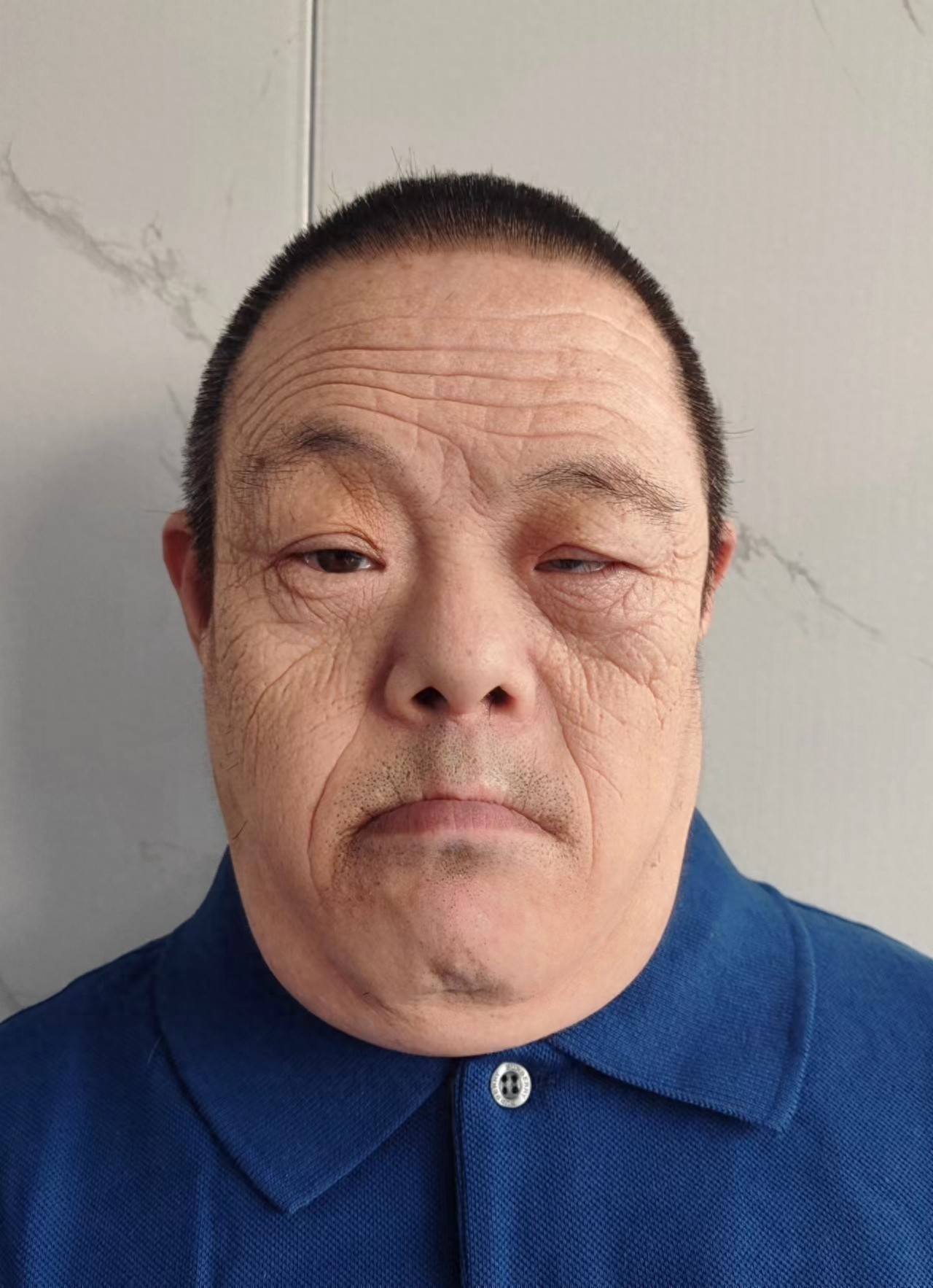 走失者照片 北京市寻亲：五旬男子被救助，右下肢...