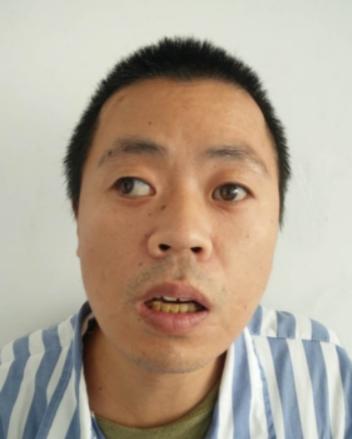 走失者照片 北京市寻亲：中年男子被救助，高约1...