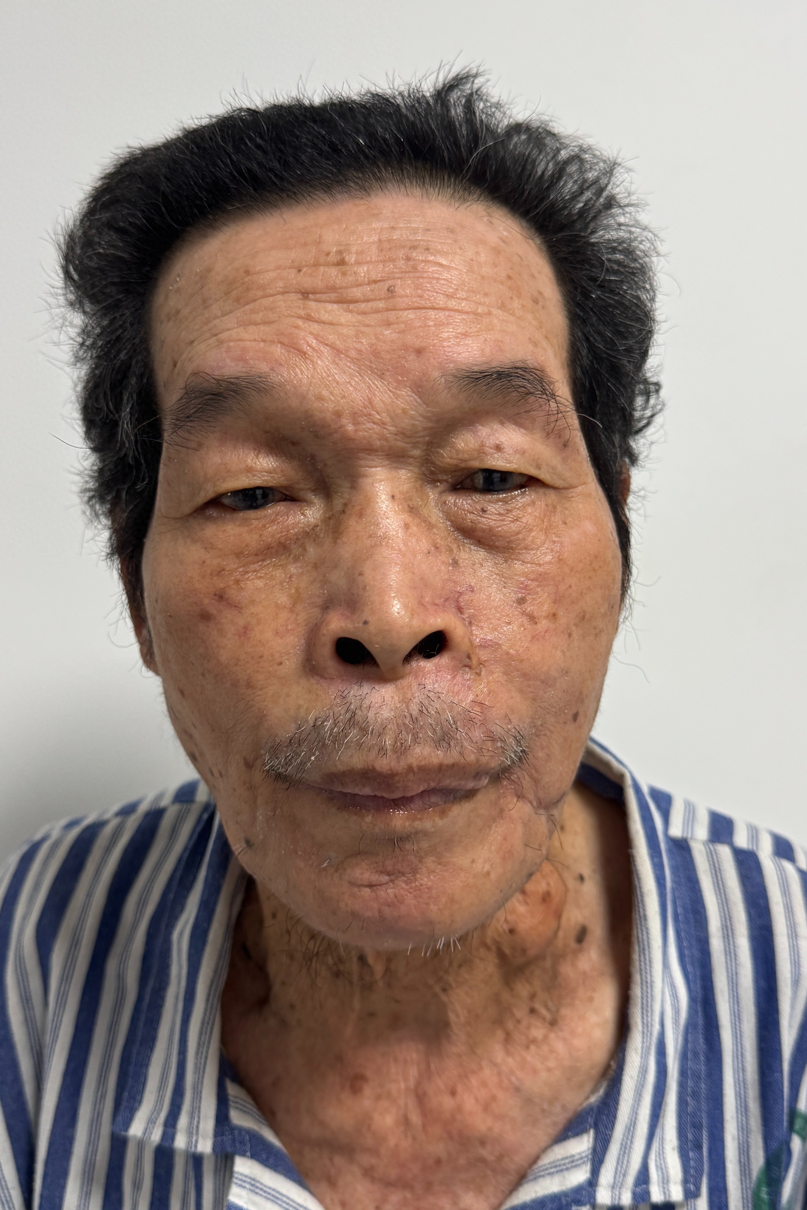 走失者照片 玉林市寻亲：七旬老人被救助，穿黑色...