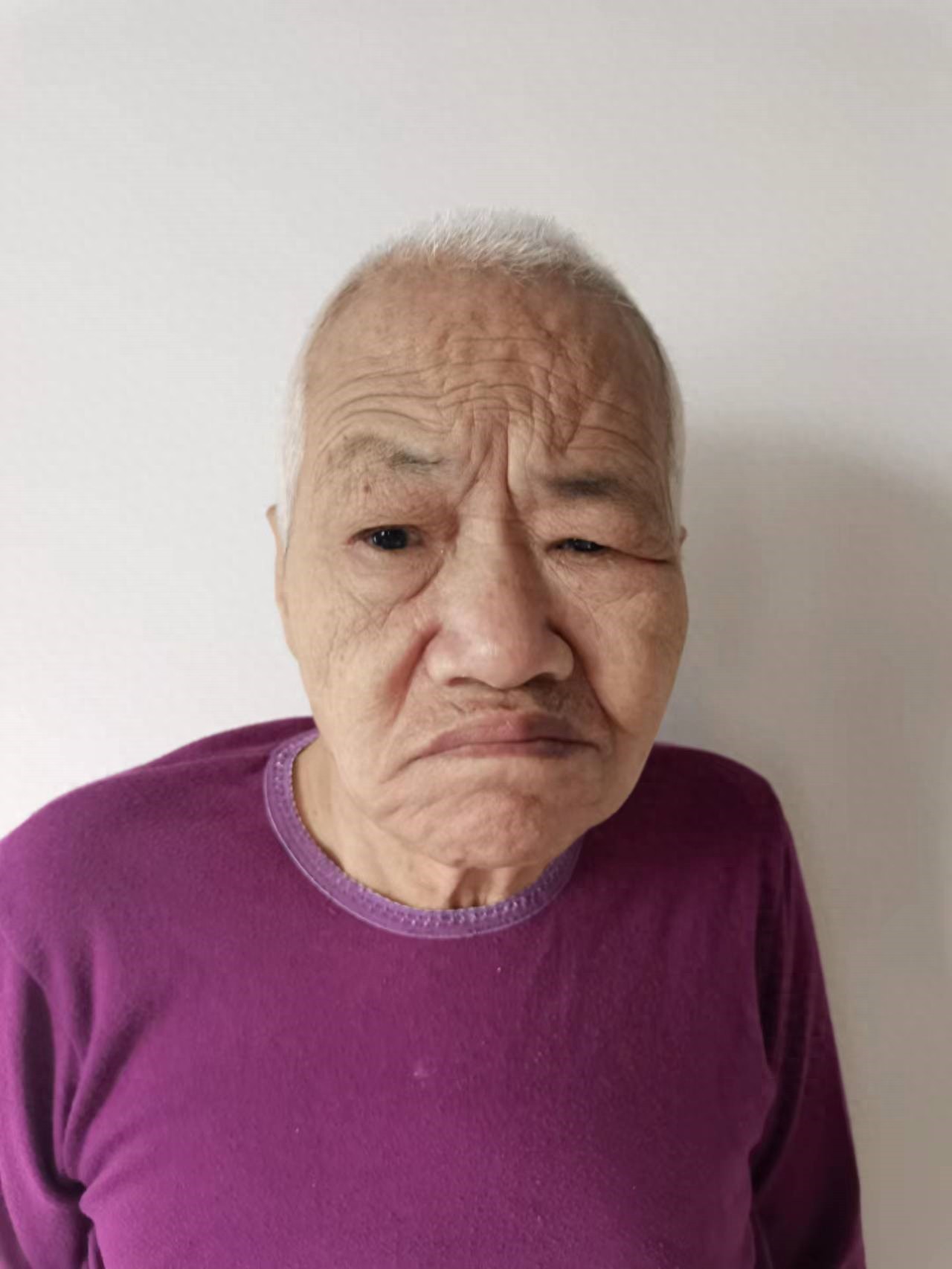 走失者照片 北京市寻亲：六旬老太被救助，双目失...