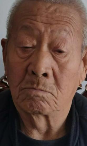 走失者照片 临汾市寻人：八旬老人走失，患阿尔茨...