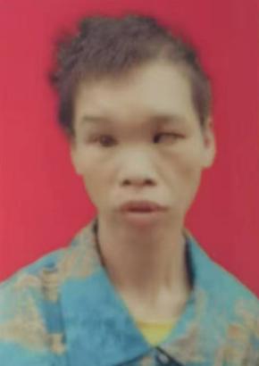 走失者照片 重庆市寻亲：青年女子被救助，左眼视...