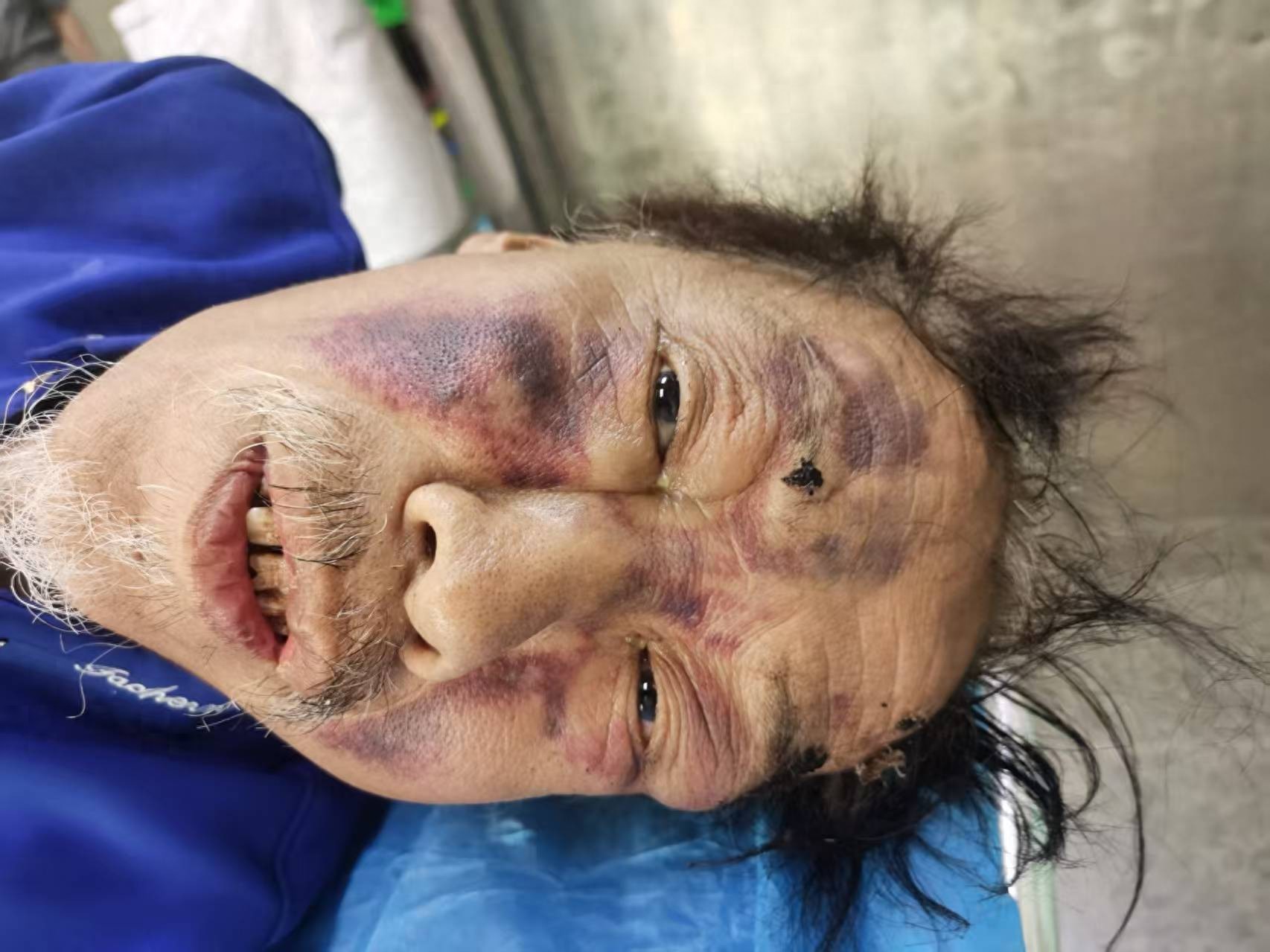 走失者照片 太原市寻亲：六旬老人被救助，自述叫...
