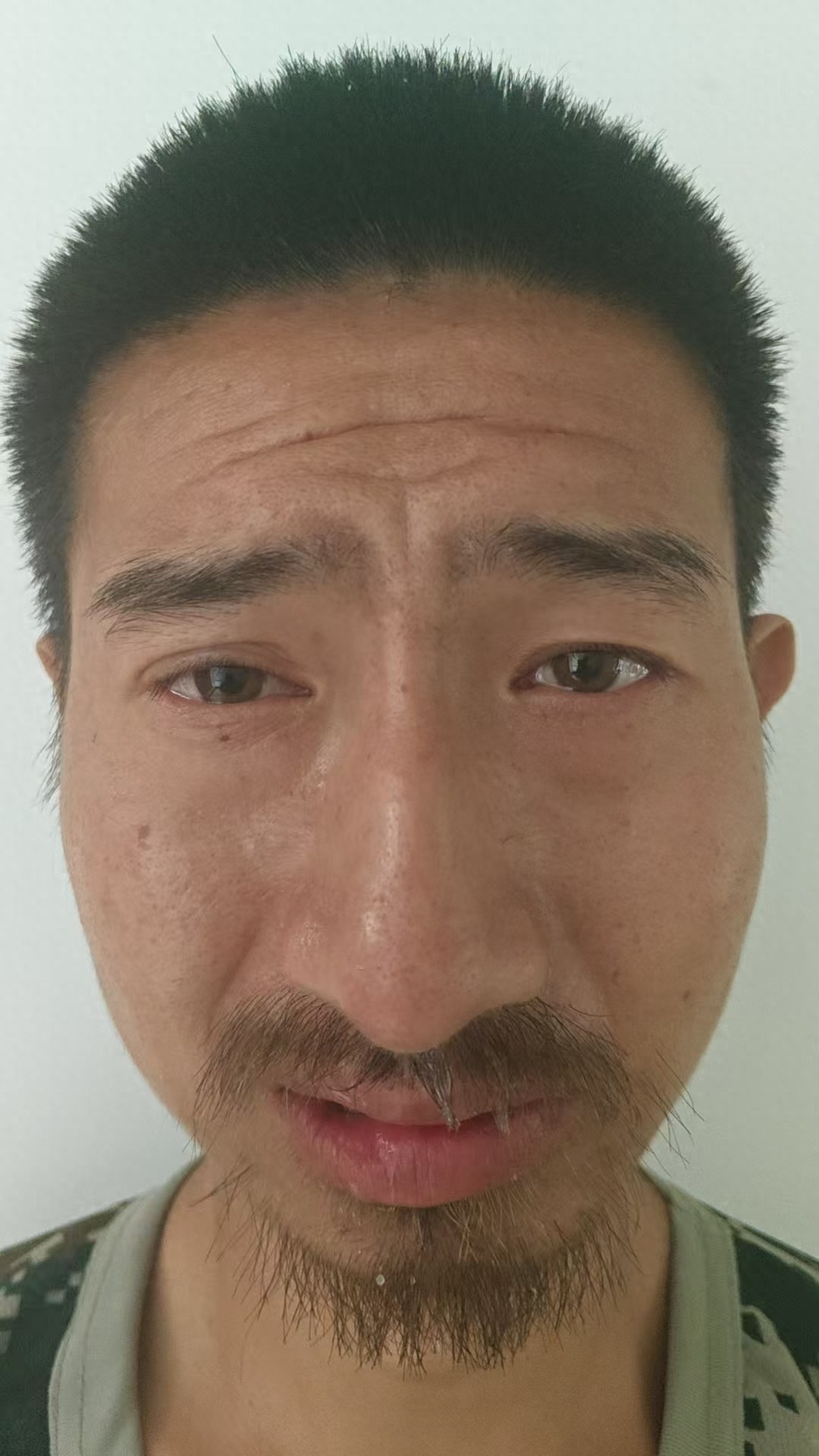 走失者照片 新乡市卫辉市寻亲：青年男子被救助，...