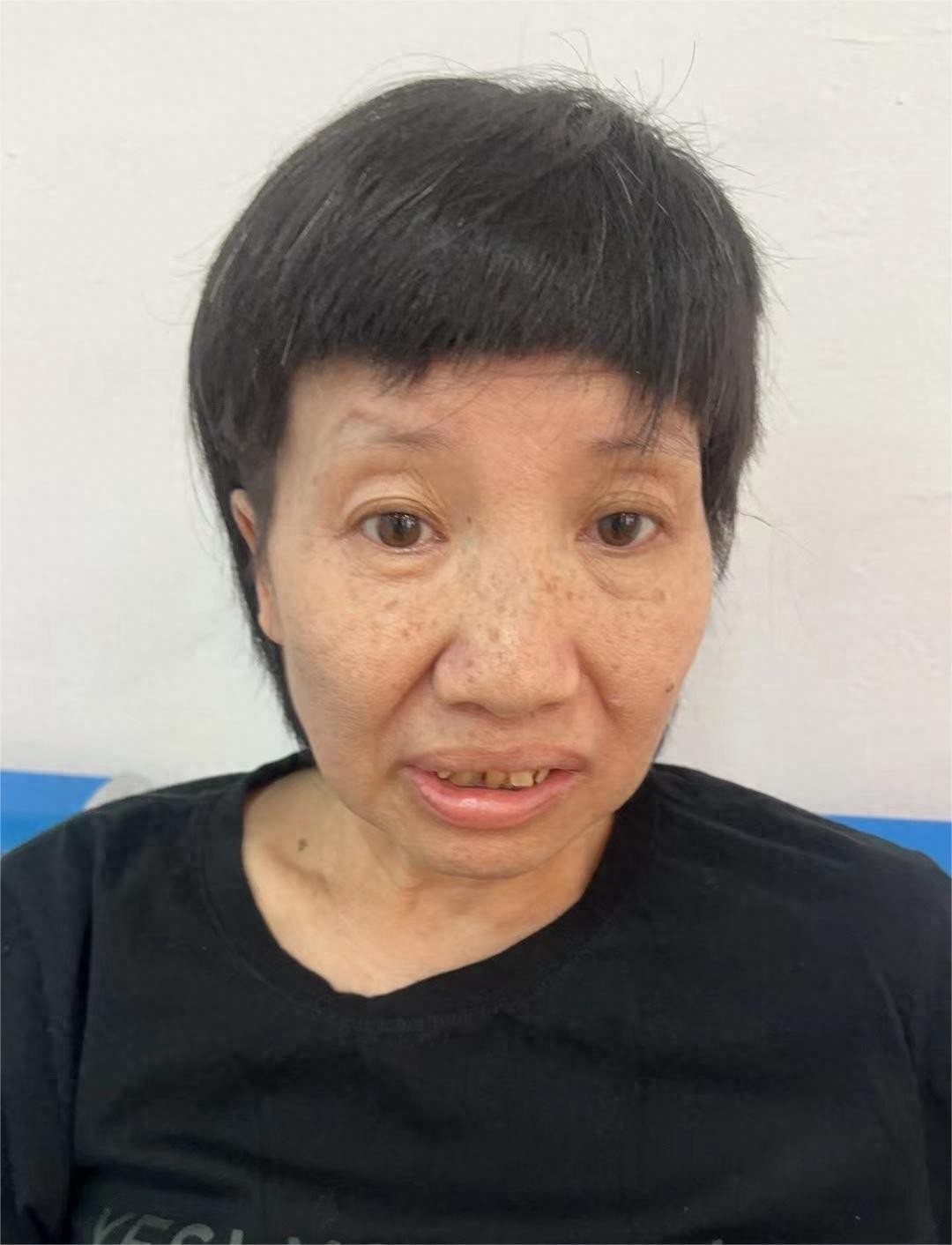 走失者照片 汕尾市陆丰市寻亲：五旬女子被救助，...