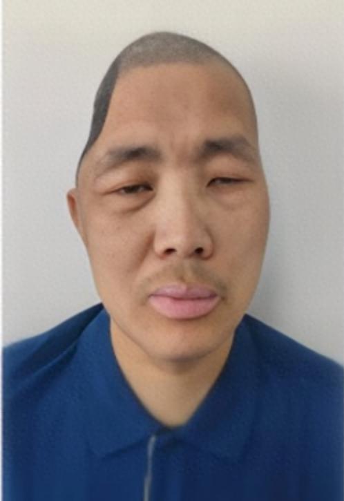 走失者照片 北京市寻亲：中年男子被救助，头部右...