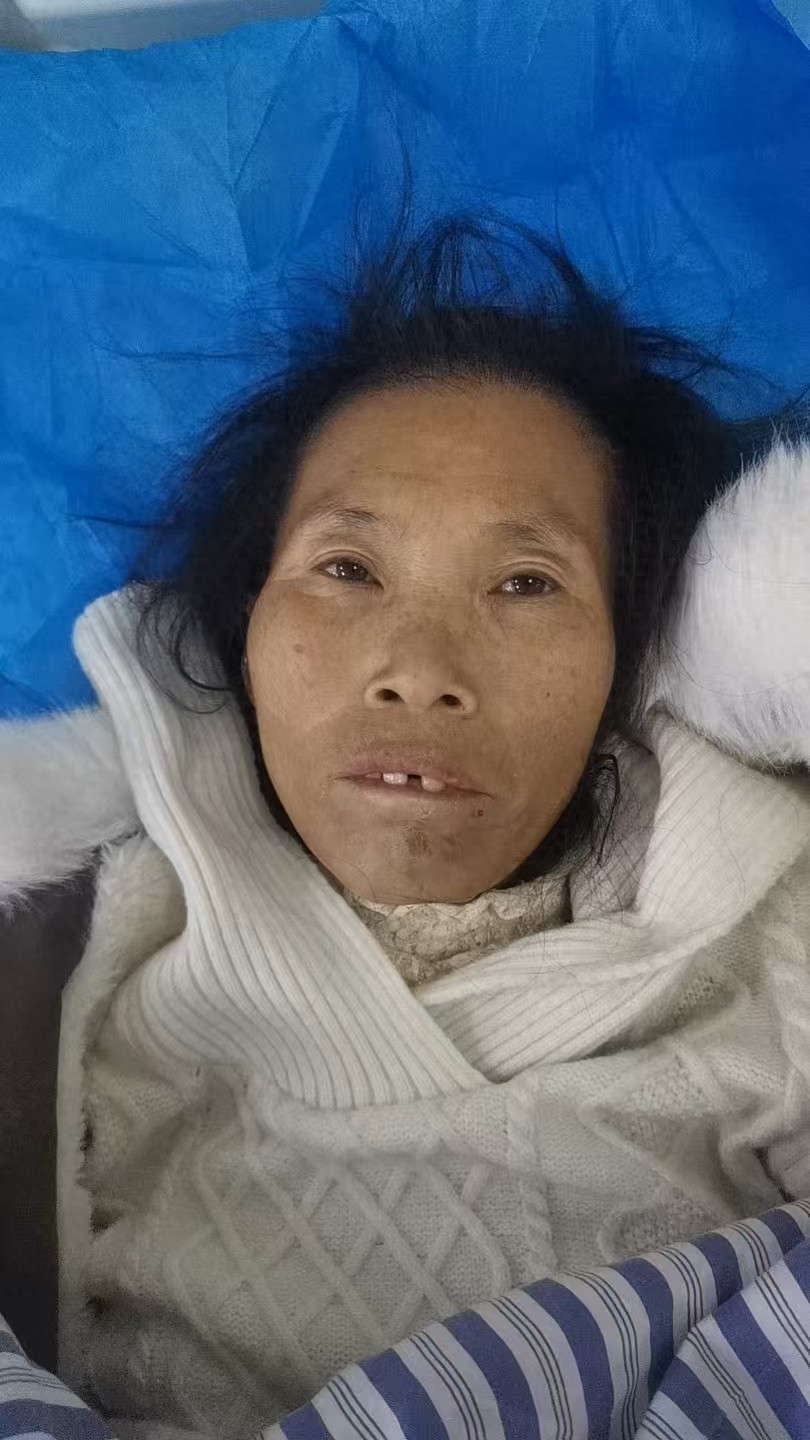 走失者照片 黔西南州寻亲：五旬女子被救助，偏瘦...