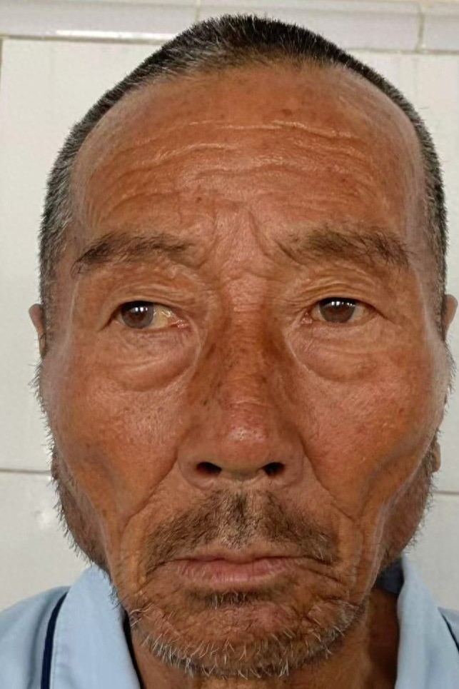 走失者照片 泰安市寻亲：七旬老人被救助，穿黑色...