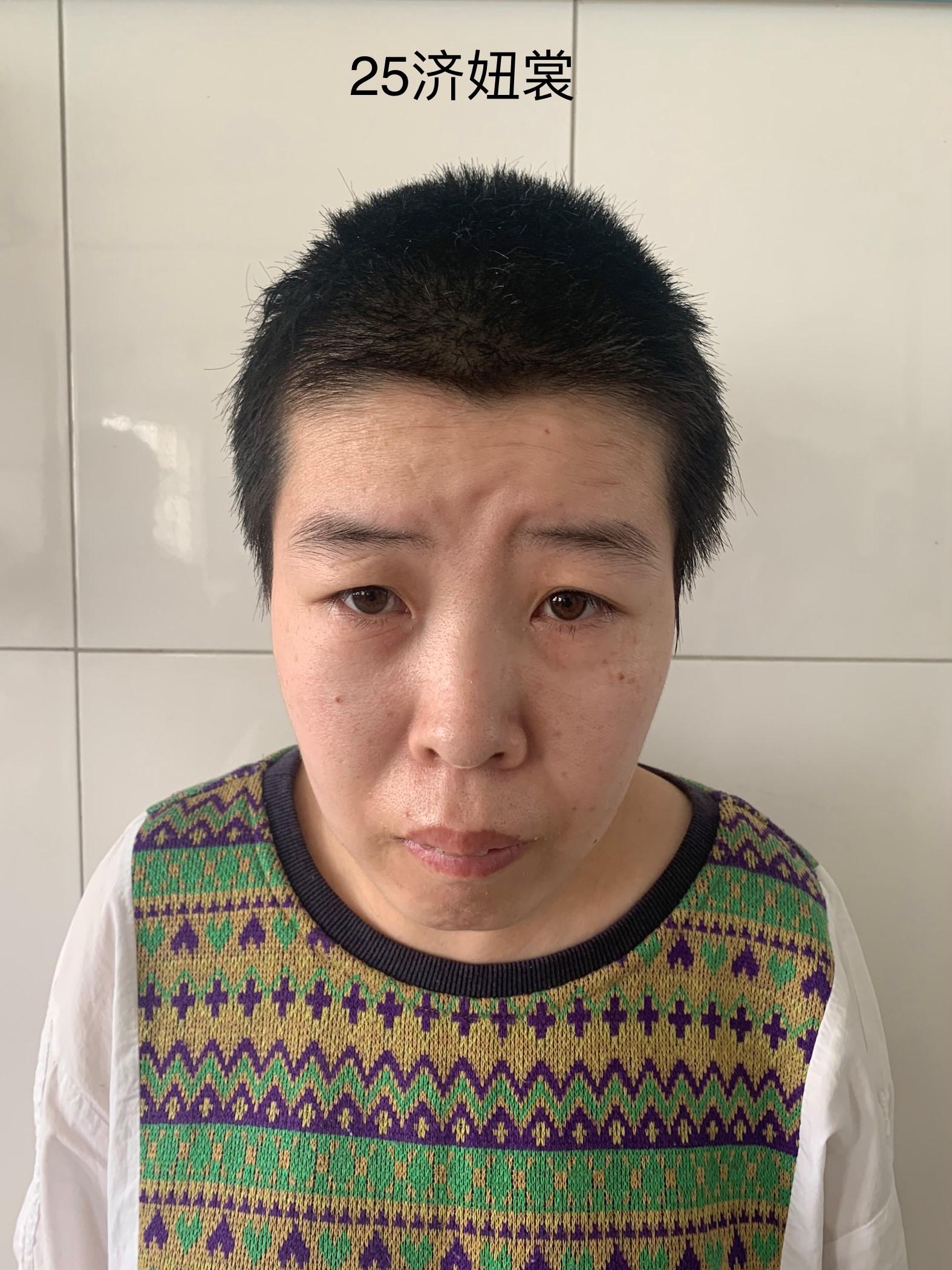 走失者照片 济南市寻亲：青年女子被救助，高1米...
