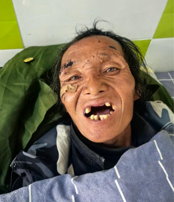 走失者照片 凉山州寻亲：五旬男子被救助，自述叫...