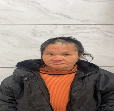 走失者照片 贵港市寻亲：中年女子被救助，穿浅蓝...