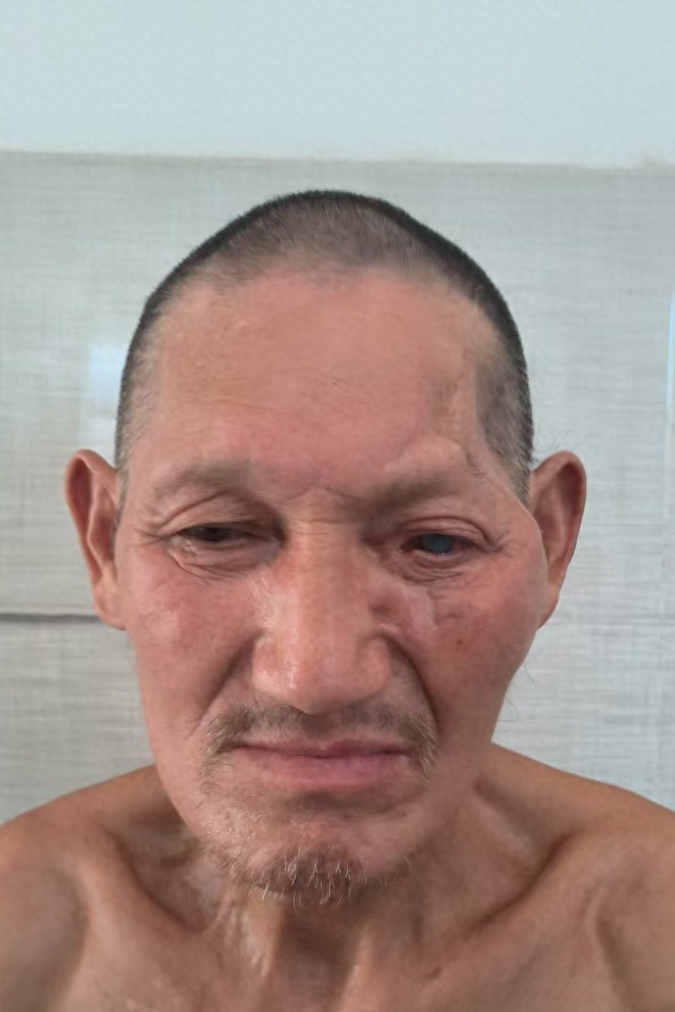 走失者照片 亳州市寻亲：五旬男子被救助，高1米...