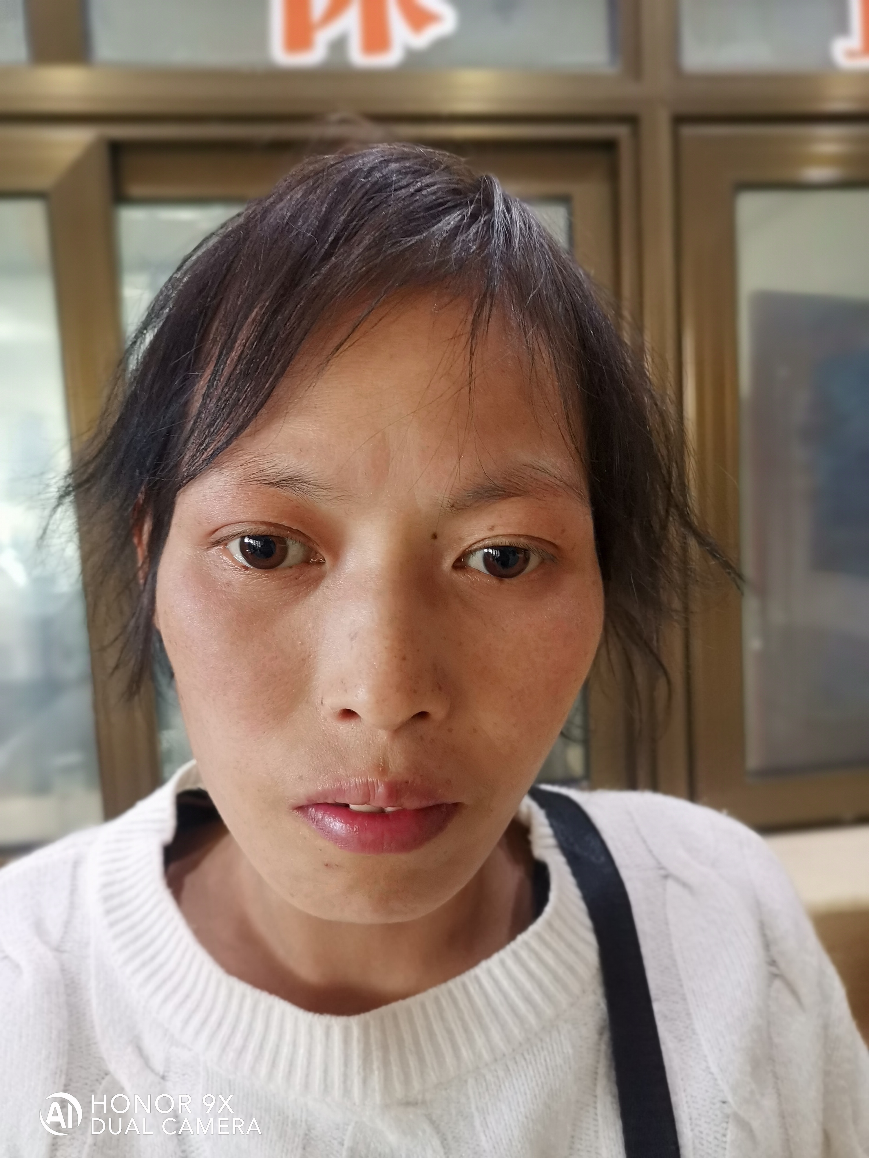 走失者照片 宿州市寻亲：中年女子被救助，疑似广...