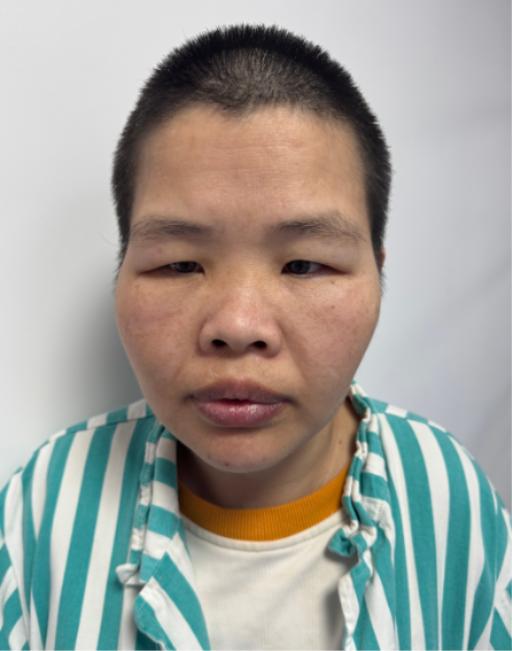 走失者照片 赣州市寻亲：中年女子被救助，自述叫...