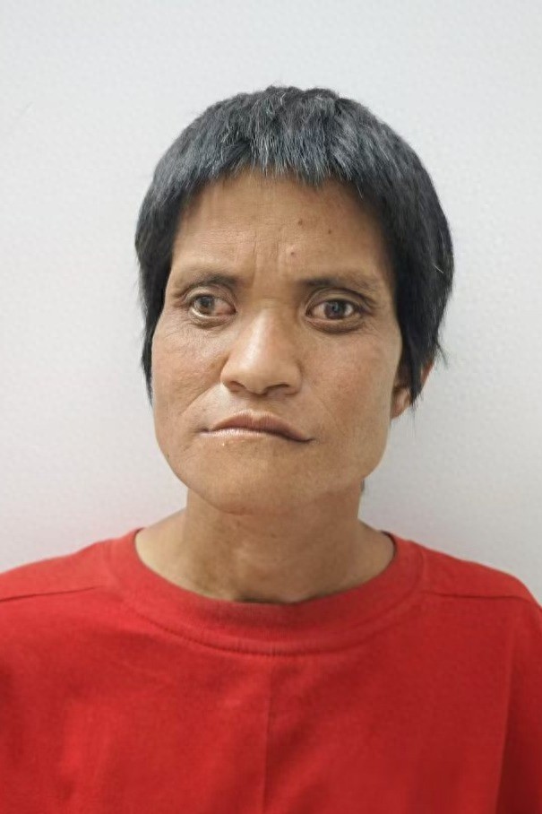 走失者照片 贵港市寻亲：中年女子被救助，疑患精...