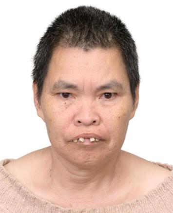 走失者照片 泉州市石狮市寻亲：五旬女子被救助，...