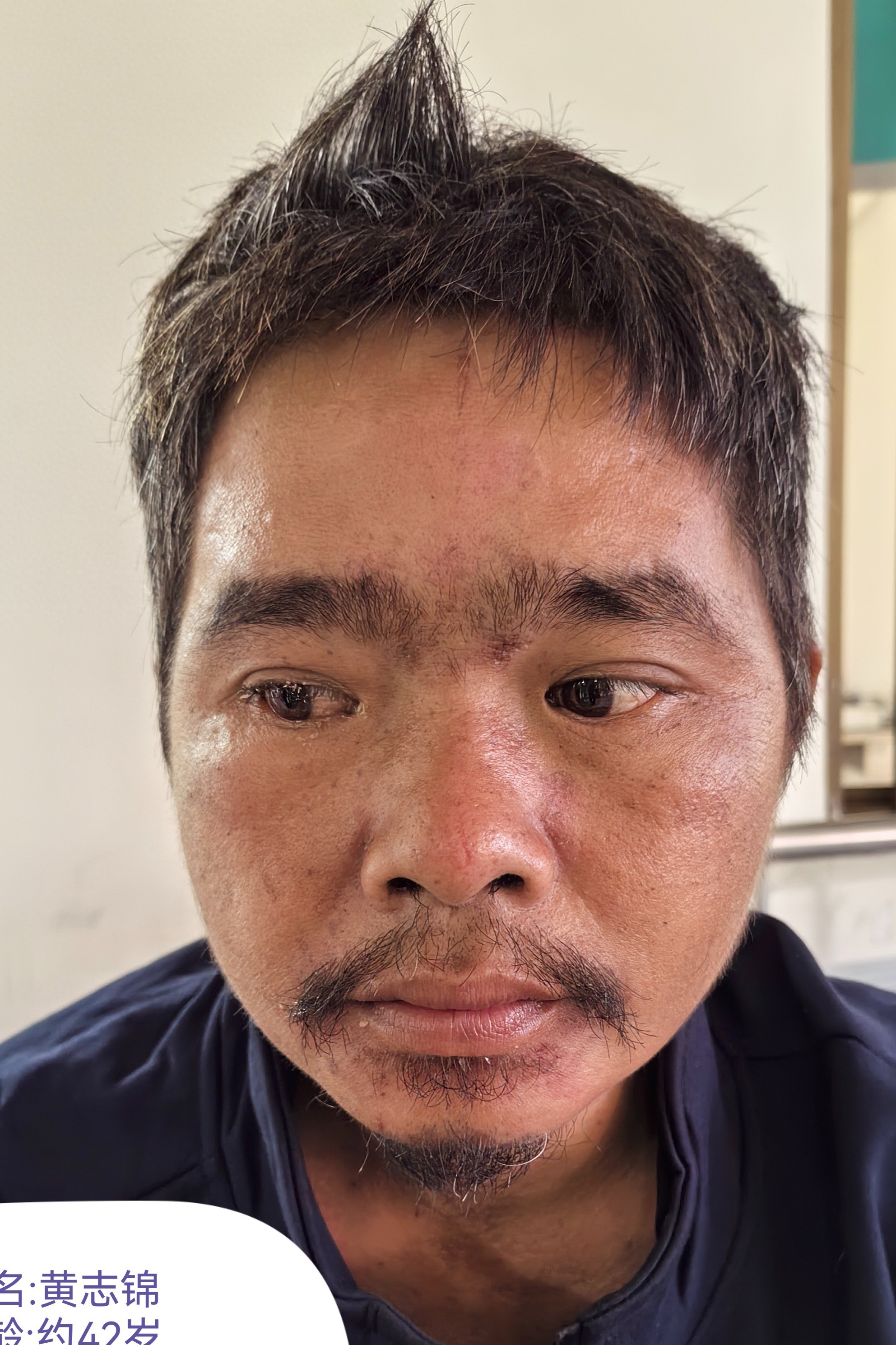 走失者照片 海口市寻亲：中年男子被救助，自述叫...