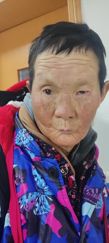 走失者照片 长沙市寻亲：七旬老太被救助，穿迷彩...