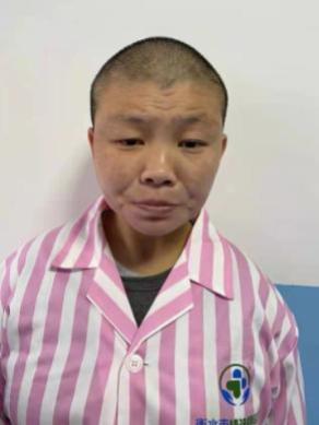 走失者照片 北京市寻亲：青年女子被救助，疑患精...