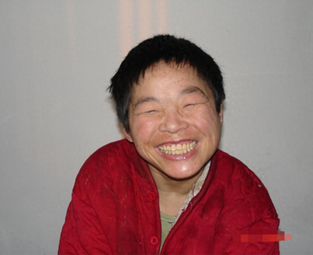 走失者照片 晋中市寻亲：中年女子被救助多年，患...