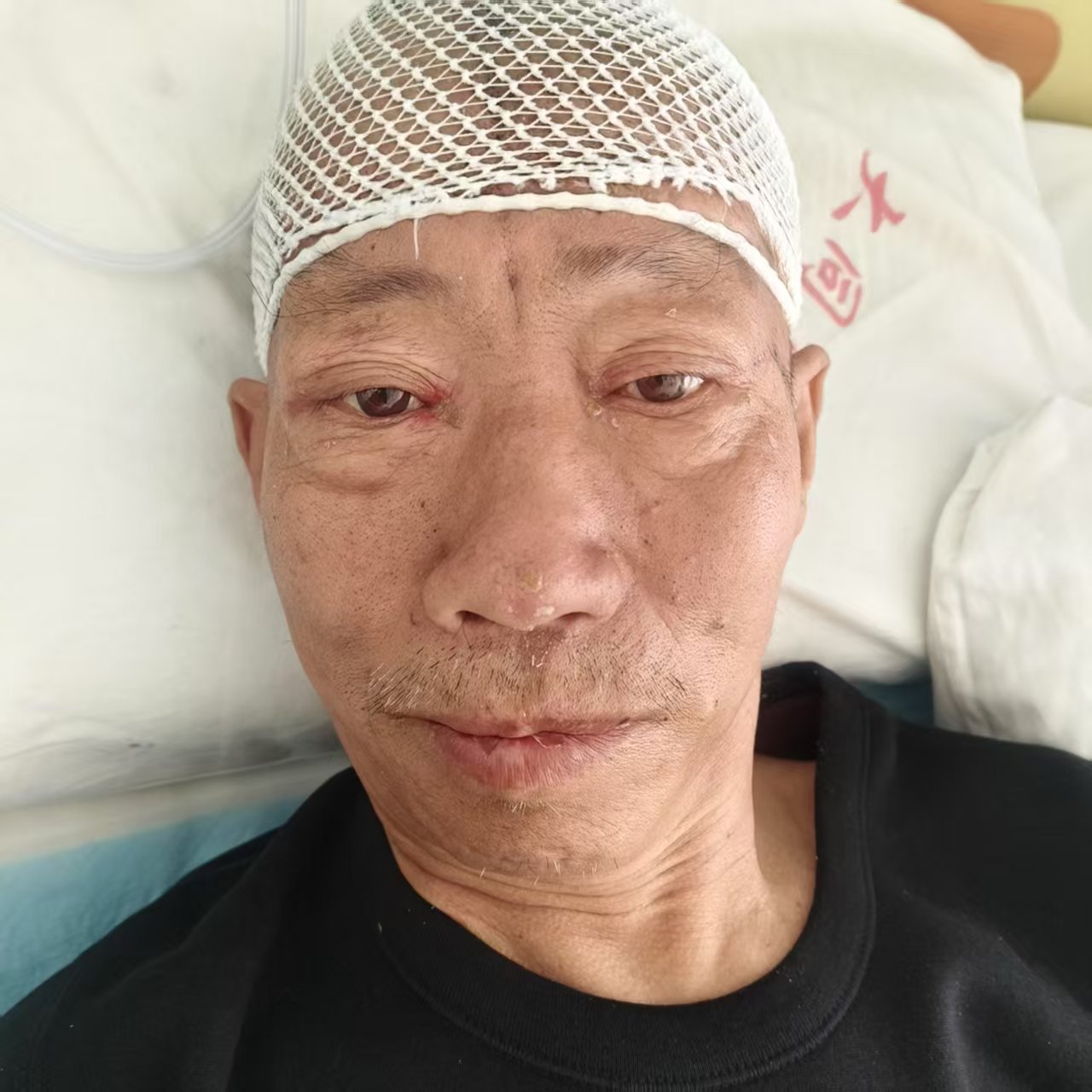 走失者照片 大同市寻亲:五旬男子被救助,自述叫...
