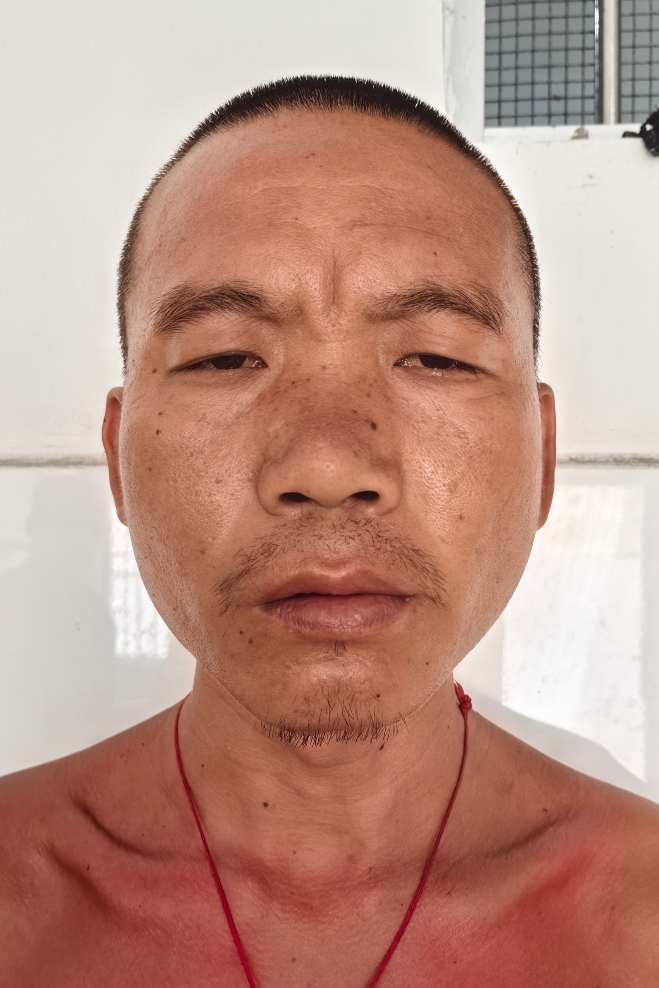 走失者照片 玉林市寻亲：青年男子被救助，穿白色...