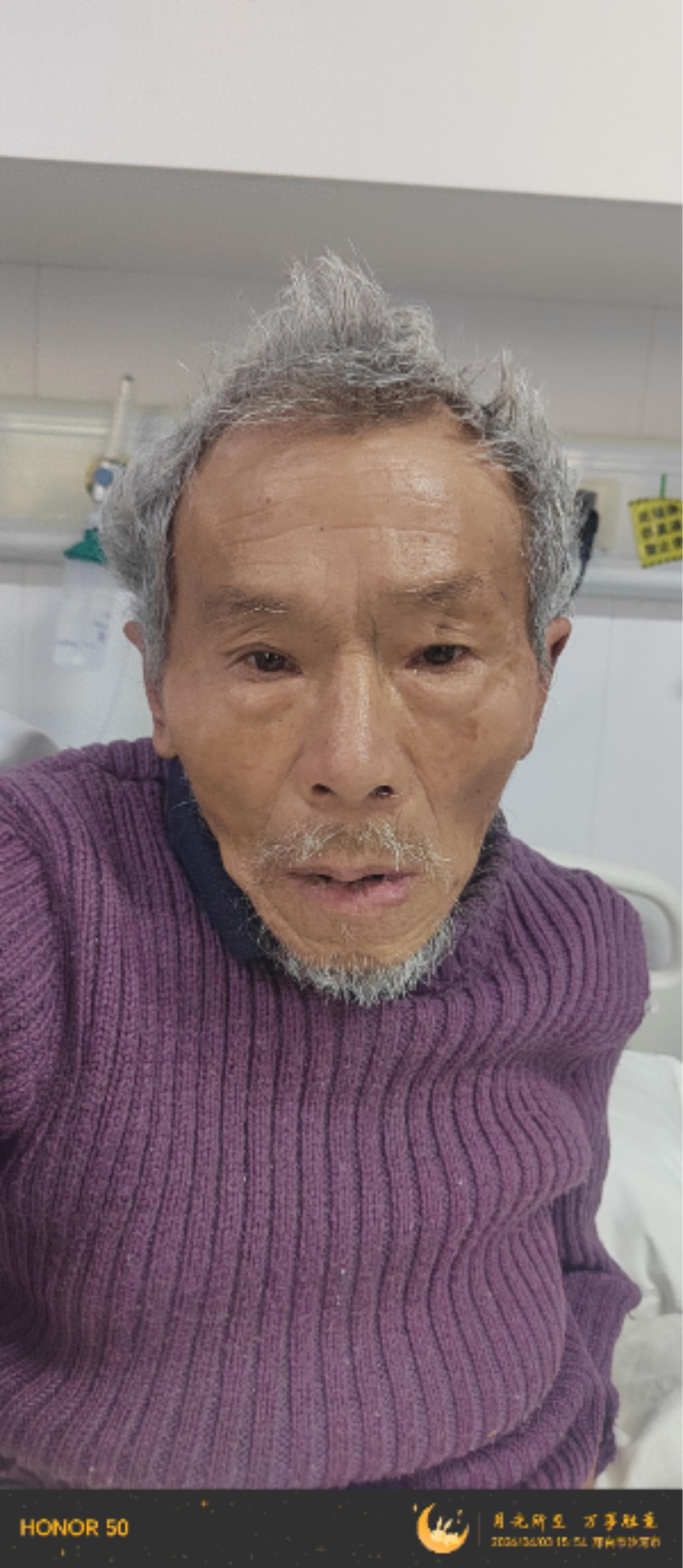走失者照片 邢台沙河寻亲：七旬老人被救助，疑似...