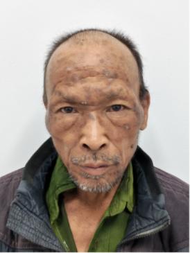 走失者照片 玉溪市寻亲：五旬男子被救助，自述叫...