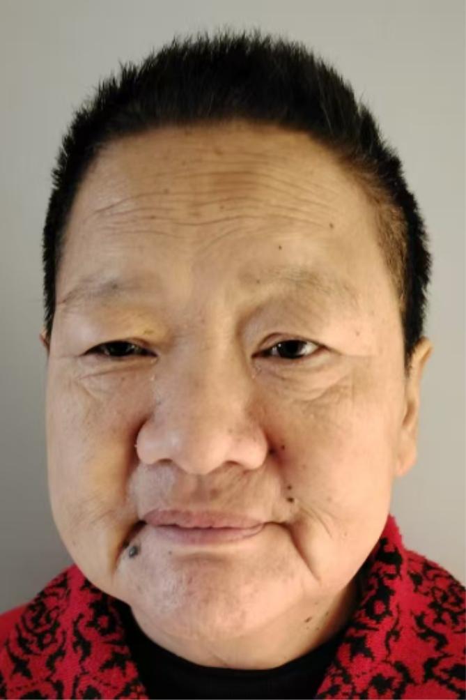 走失者照片 吴忠市寻亲：五旬女子被救助，疑似精...