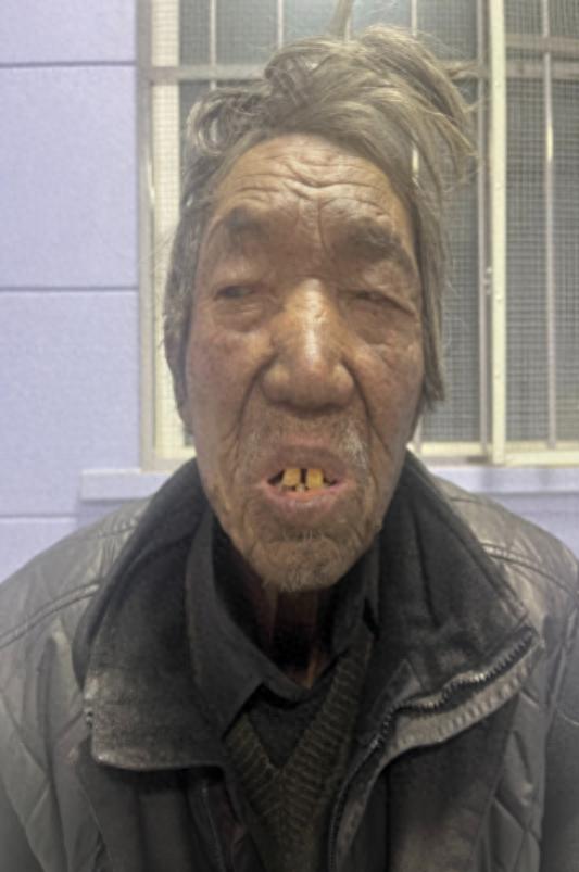 走失者照片 吉林市桦甸市寻亲：五旬男子被救助，...