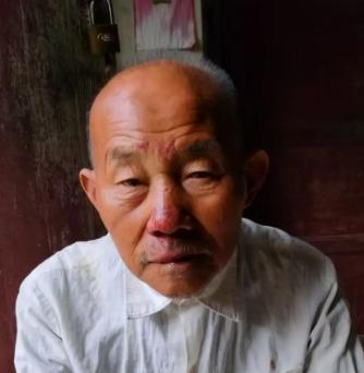 走失者照片 黄冈市武穴市寻人：八旬老人走失，穿...