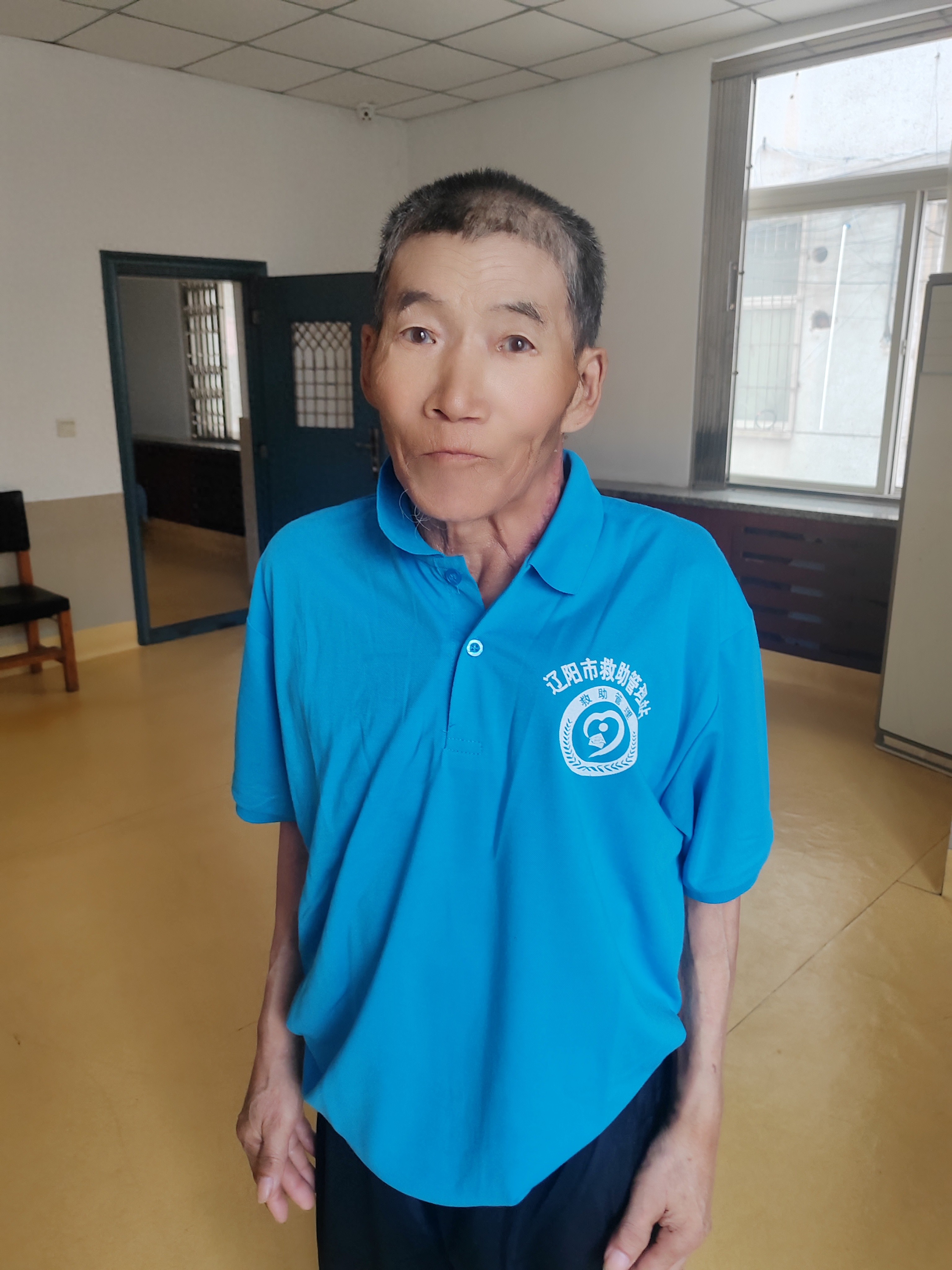 走失者照片 辽阳市寻亲：六旬老人被救助，高1米...