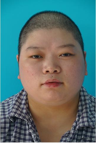 走失者照片 宁波市寻亲：青年女子被救助，自述叫...