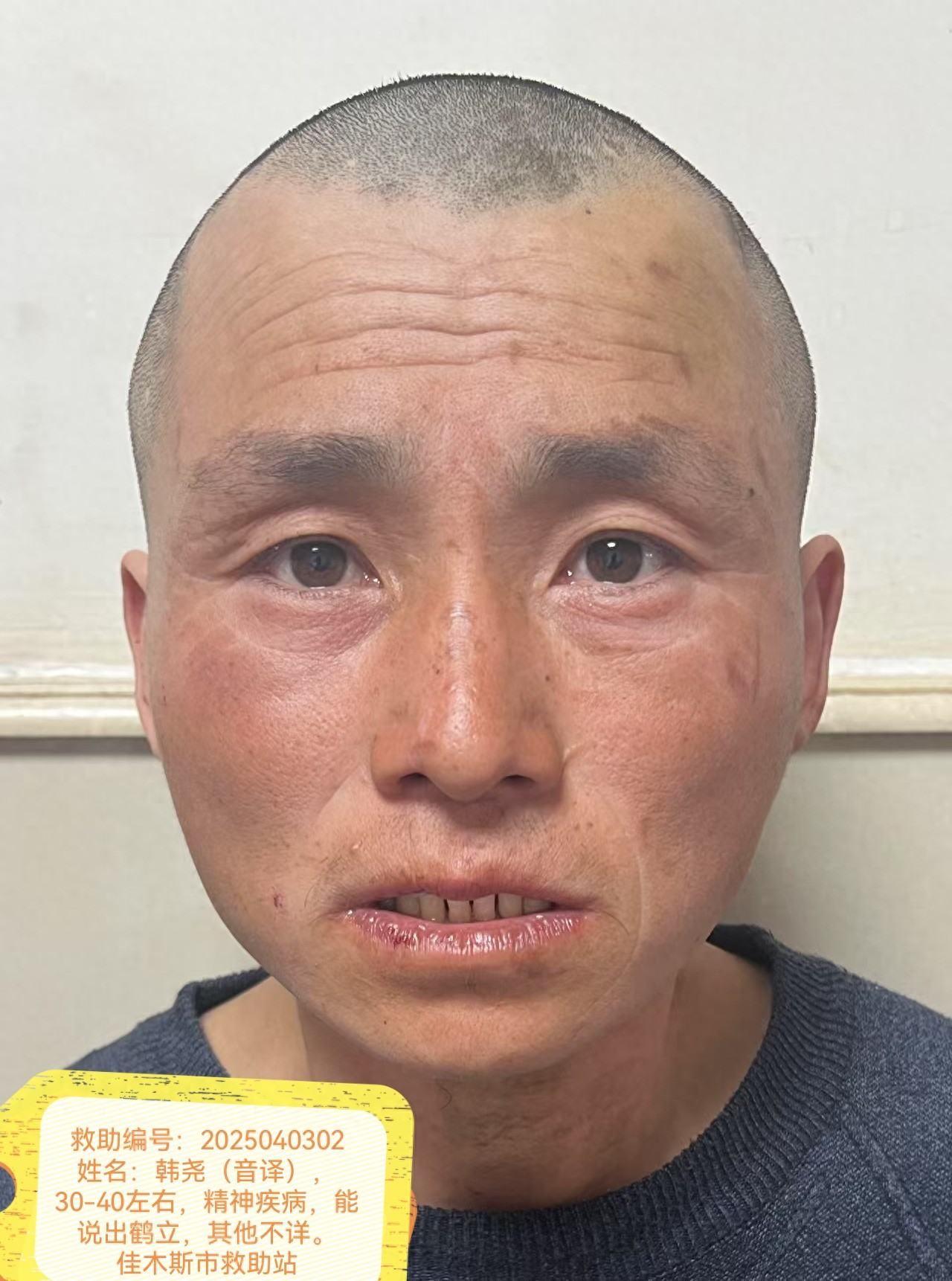 走失者照片 佳木斯市寻亲：中年男子被救助，自述...