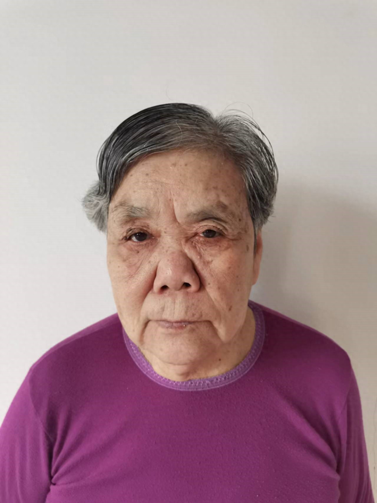 走失者照片 北京市寻亲：七旬老太被救助，头顶有...