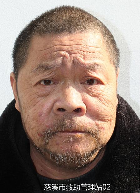 走失者照片 宁波市慈溪市寻亲：六旬老人被救助，...