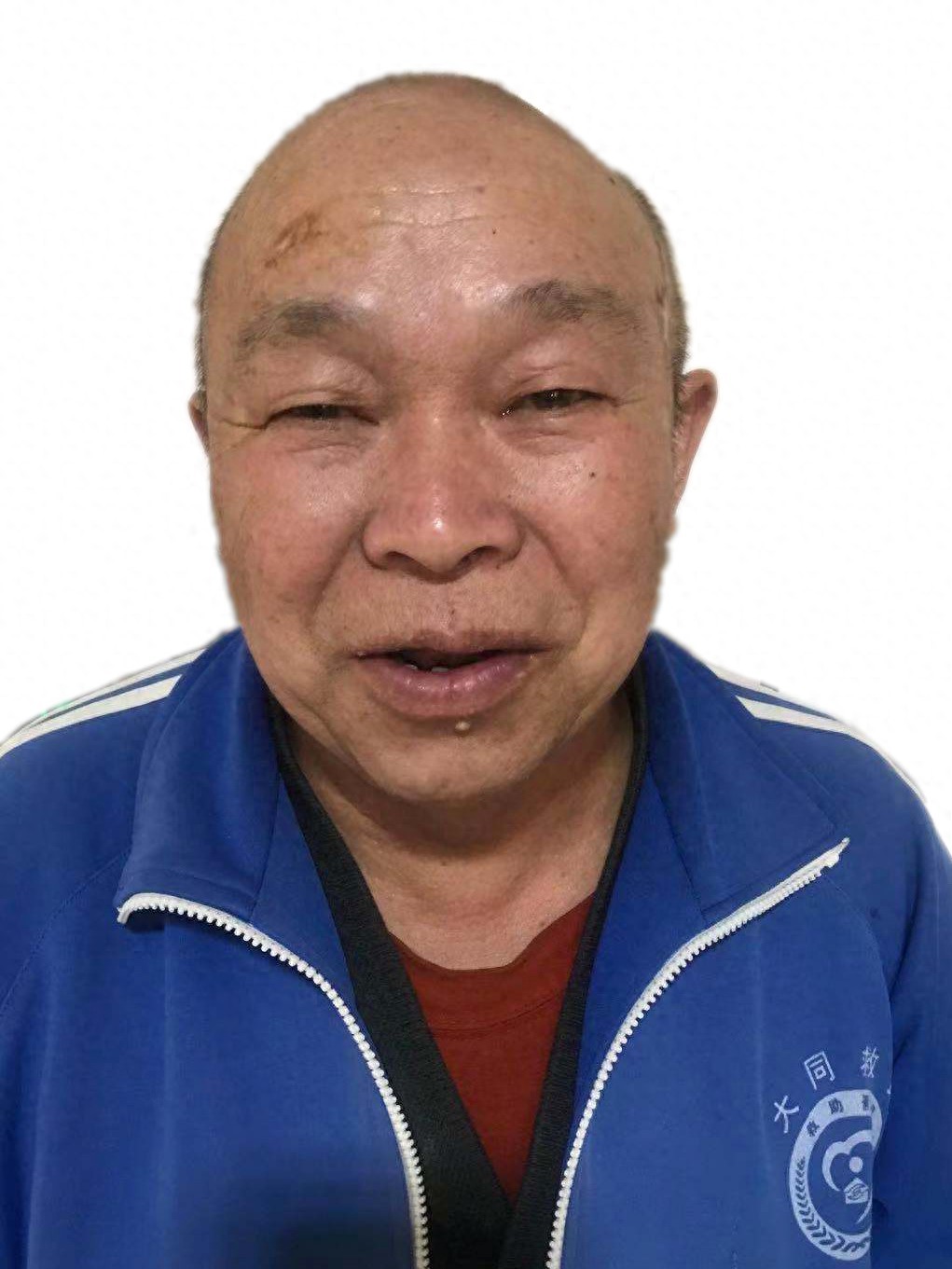 走失者照片 大同市寻亲：六旬老人被救助，手指弯...