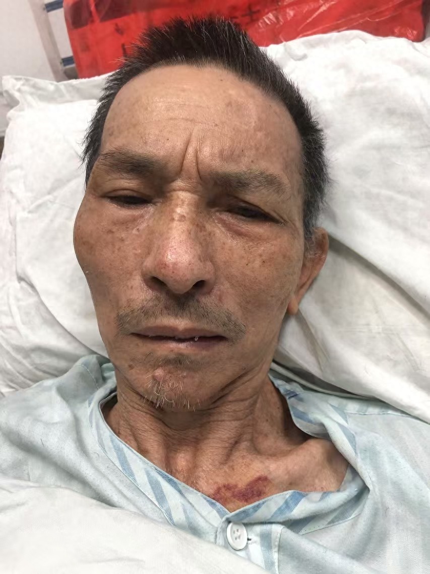 走失者照片 佛山市寻亲：六旬老人被救助，高1米...