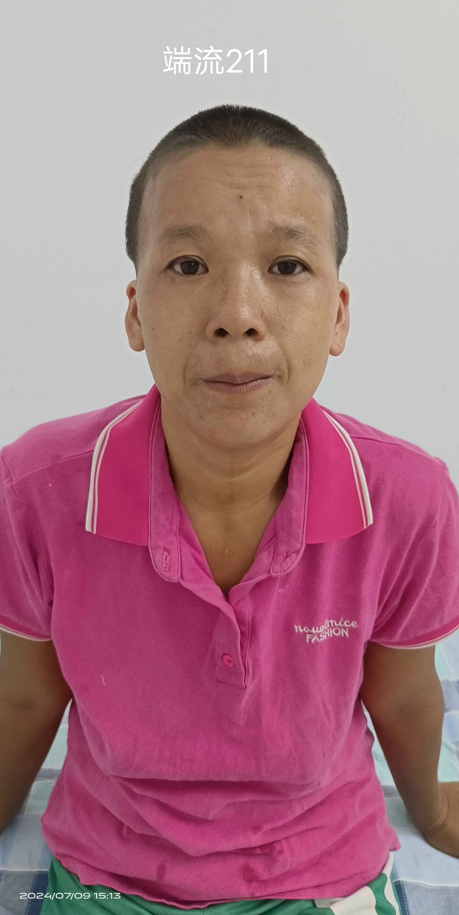走失者照片 肇庆市寻亲：五旬女子被救助，疑似精...