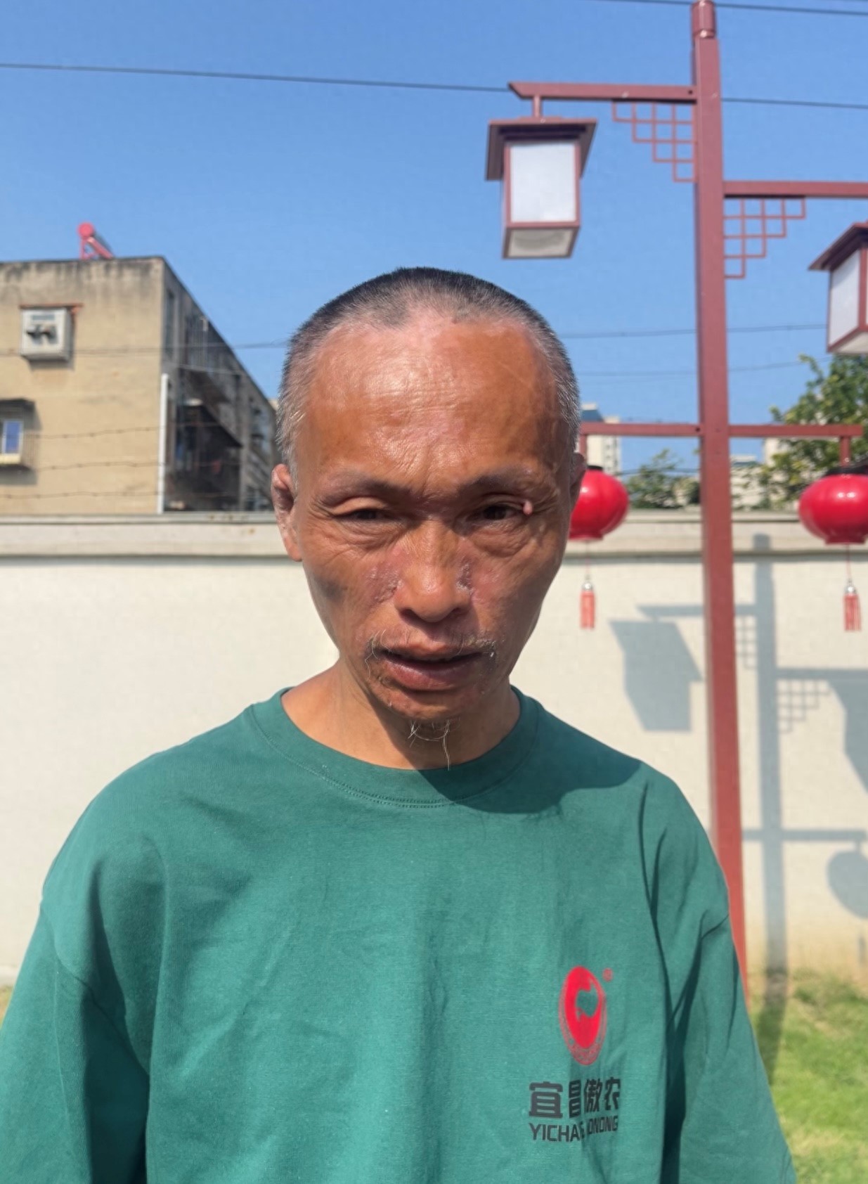 走失者照片 湖北省神农架林区寻亲：五旬男子被救...