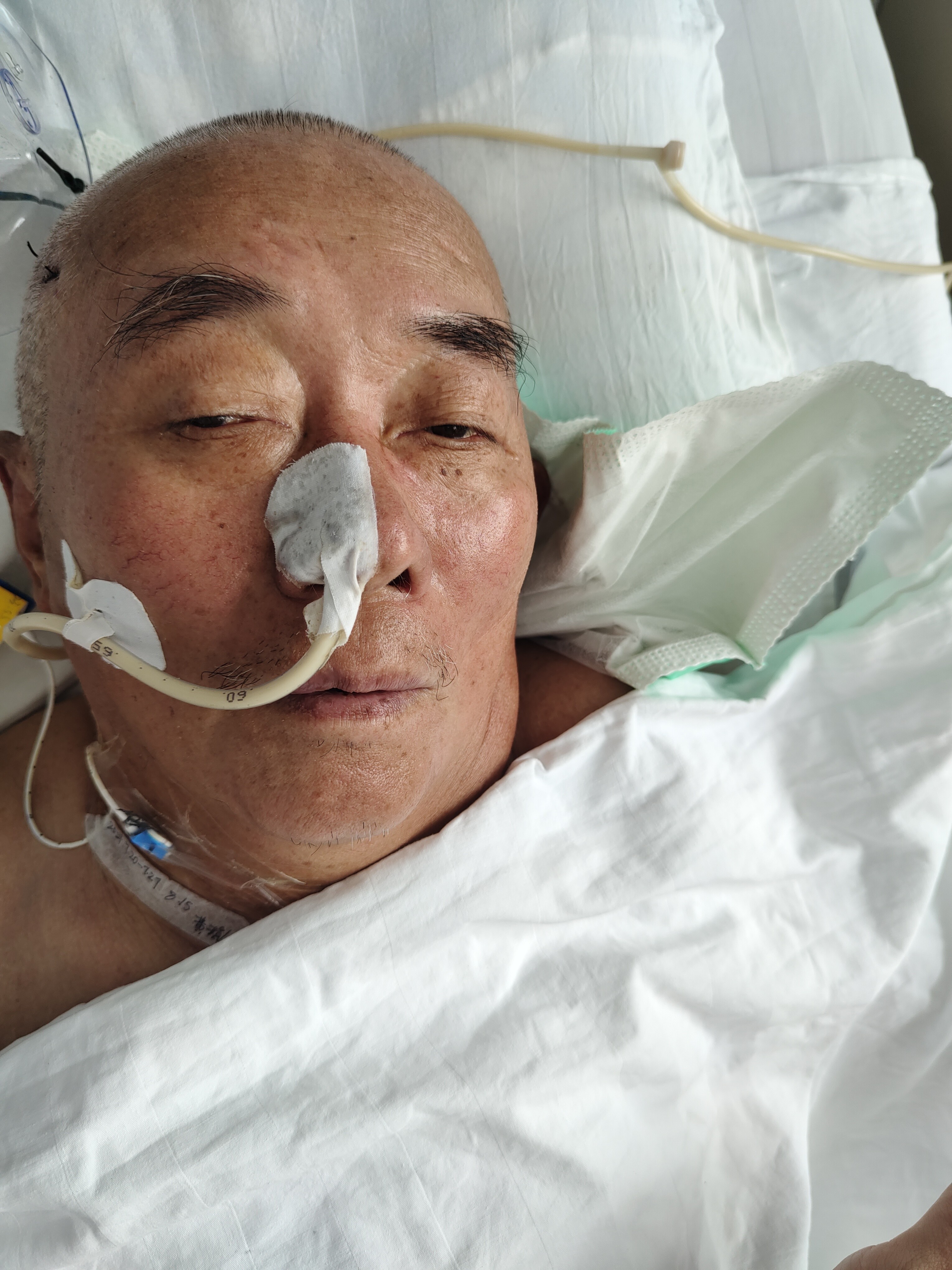 走失者照片 文山州文山市寻亲：五旬男子被救助，...