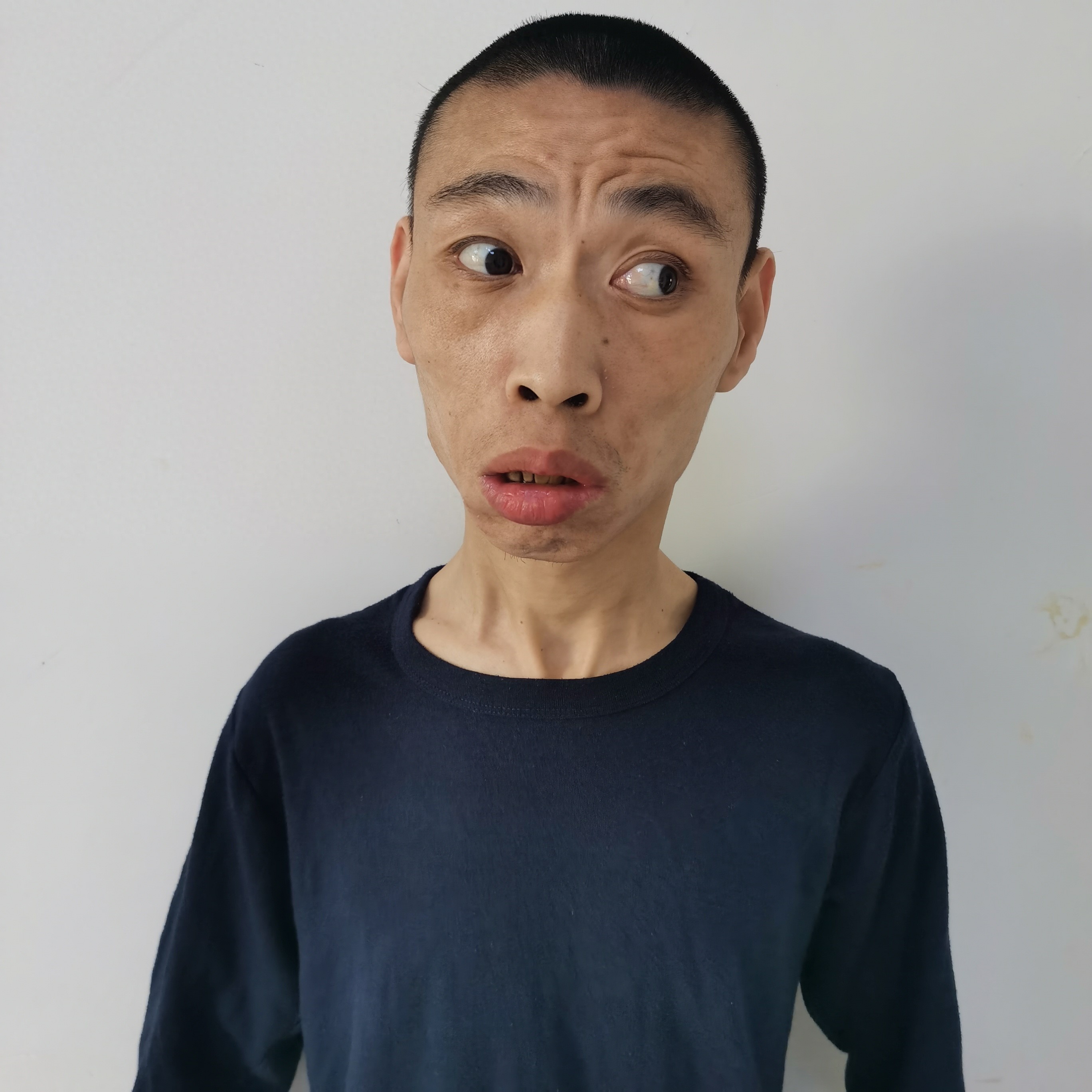 走失者照片 北京市寻亲：青年男子被救助，双手畸...