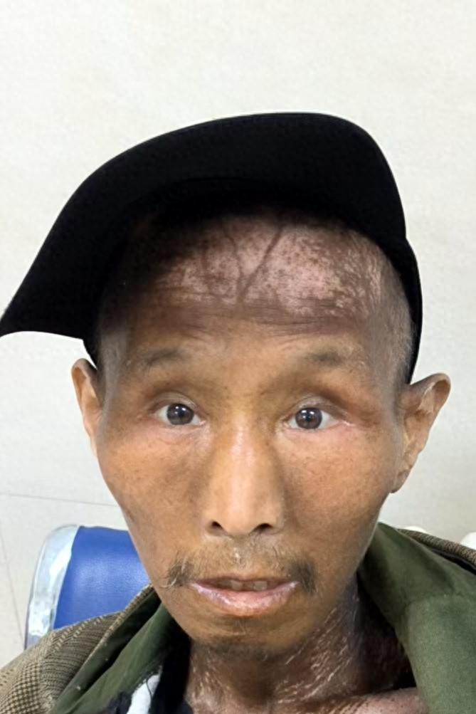 走失者照片 哈尔滨市寻亲：中年男子被救助，自述...