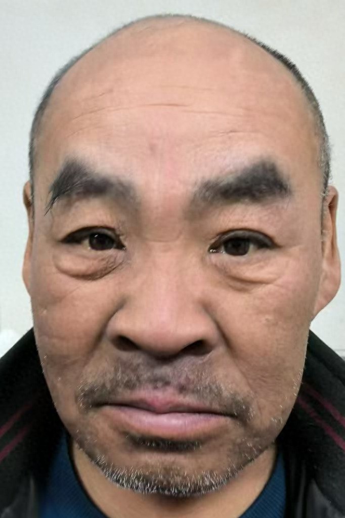走失者照片 哈尔滨市寻亲：五旬男子被救助，自述...